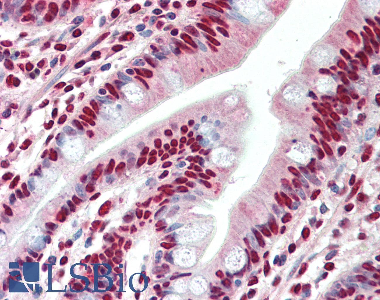 IHC-plus™ Polyclonal Goat anti-Human HNRNPA2B1 Antibody (aa127-137, IHC, WB)