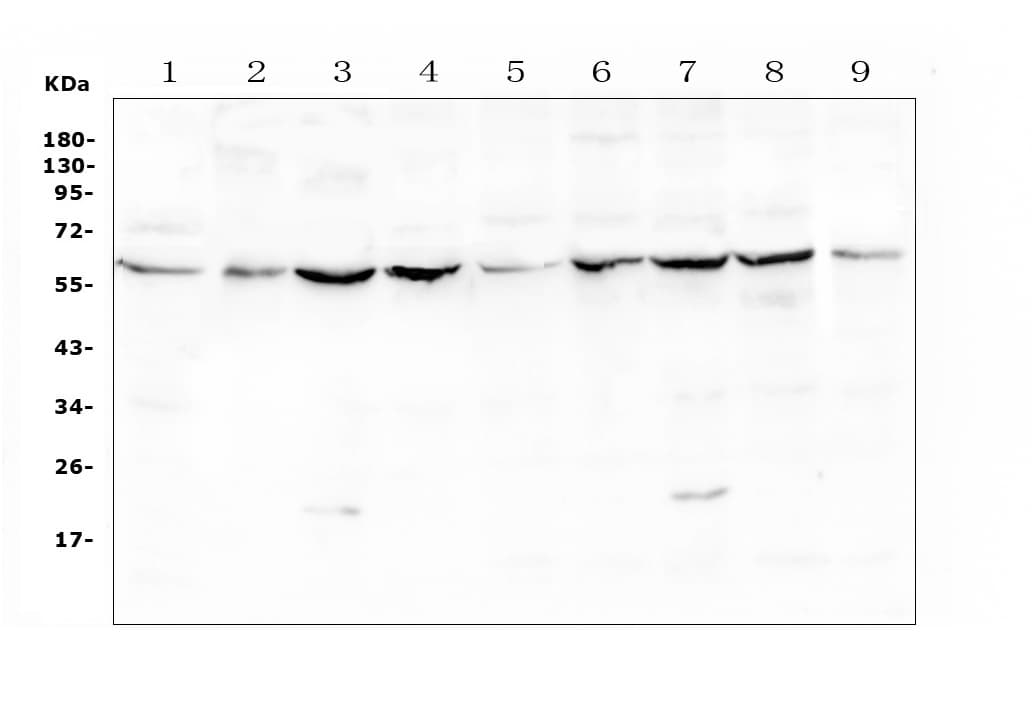 Polyclonal Rabbit anti-Human Lumican Antibody (IHC, WB)