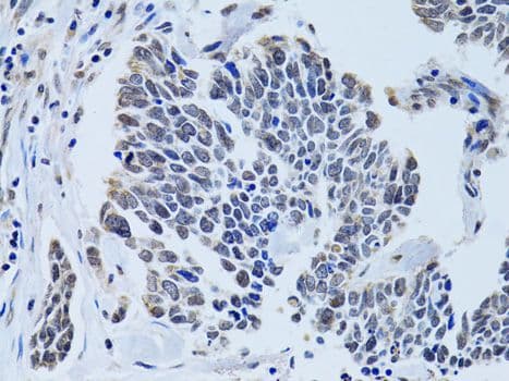 SIN3A Antibody (aa1-120)