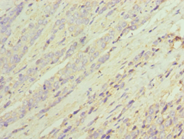 DDX / AKR1C3 Antibody (aa1-323)