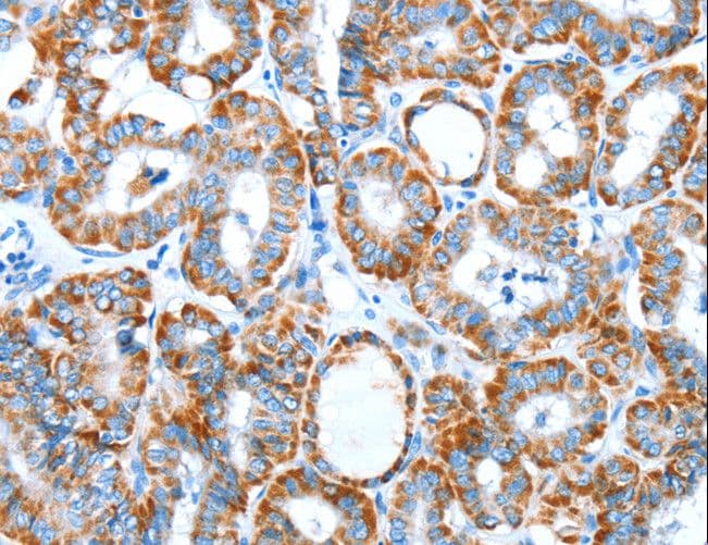 ALDH5A1 Antibody