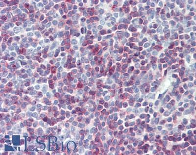 IHC-plus™ Polyclonal Goat anti-Human HUWE1 / ARFBP1 Antibody (aa2250-2300, IHC, WB)