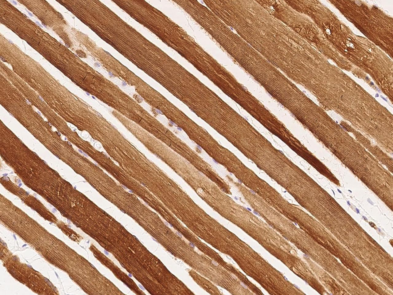 Polyclonal Rabbit anti-Human CRYAB / Alpha B Crystallin Antibody (Preservative Free, IHC, WB)
