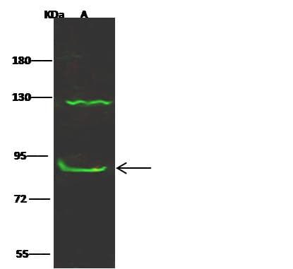 Polyclonal Rabbit anti-Human CTNNA3 / Alpha-3 Catenin Antibody (Preservative Free, WB)