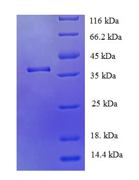 Human JMJD7 Protein (Recombinant His)