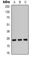 HSPB1 / HSP27 Antibody (phospho-Ser82)