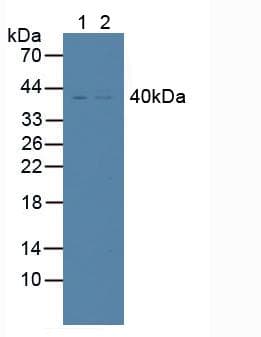 TNFRSF10B / Killer / DR5 Antibody (aa234-435, APC)