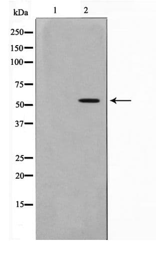 Polyclonal Rabbit anti-Human GABRG1 Antibody (WB)