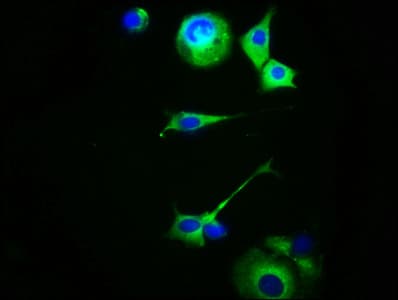 MC5R / MC5 Receptor Antibody