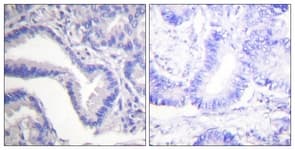 CASP7 / Caspase 7 Antibody (aa149-198)