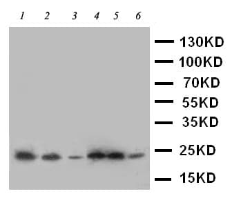 Polyclonal Rabbit anti-Human SSR3 / TRAP-Gamma Antibody (aa8-23, IHC, WB)