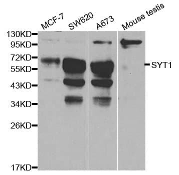 IHC-plus™ SYT1 / Synaptotagmin Antibody