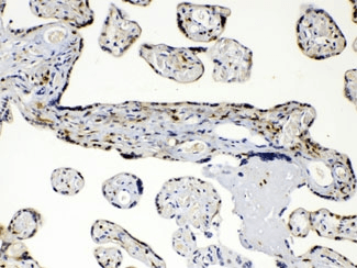 AKR1B1 / Aldose Reductase Antibody