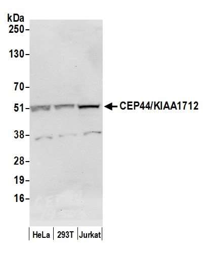 Polyclonal Rabbit anti-Human CEP44 / KIAA1712 Antibody (aa340-390, WB)