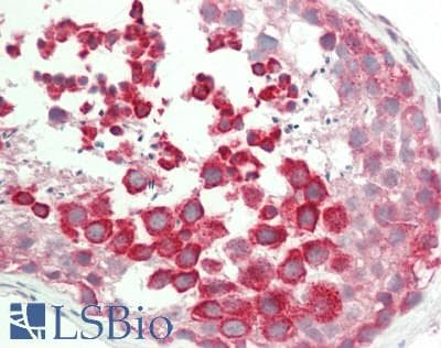 TEX264 Antibody (aa143-192)