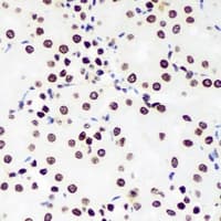 Polyclonal Rabbit anti-Human ZNF169 Antibody (IHC, WB)