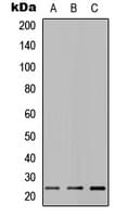 MUC16 / CA125 Antibody (Internal)