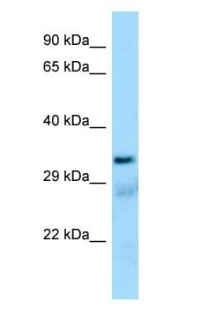 Polyclonal Rabbit anti-Human SUCLG1 / GALPHA Antibody (aa92-141, WB)