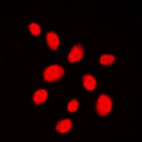 Polyclonal Rabbit anti-Human TP53BP1 / 53BP1 Antibody (N-Terminus, IHC, IF, WB)
