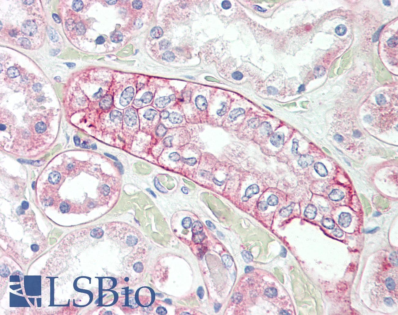 IHC-plus™ FLOT1 / Flotillin 1 Antibody (aa415-427)