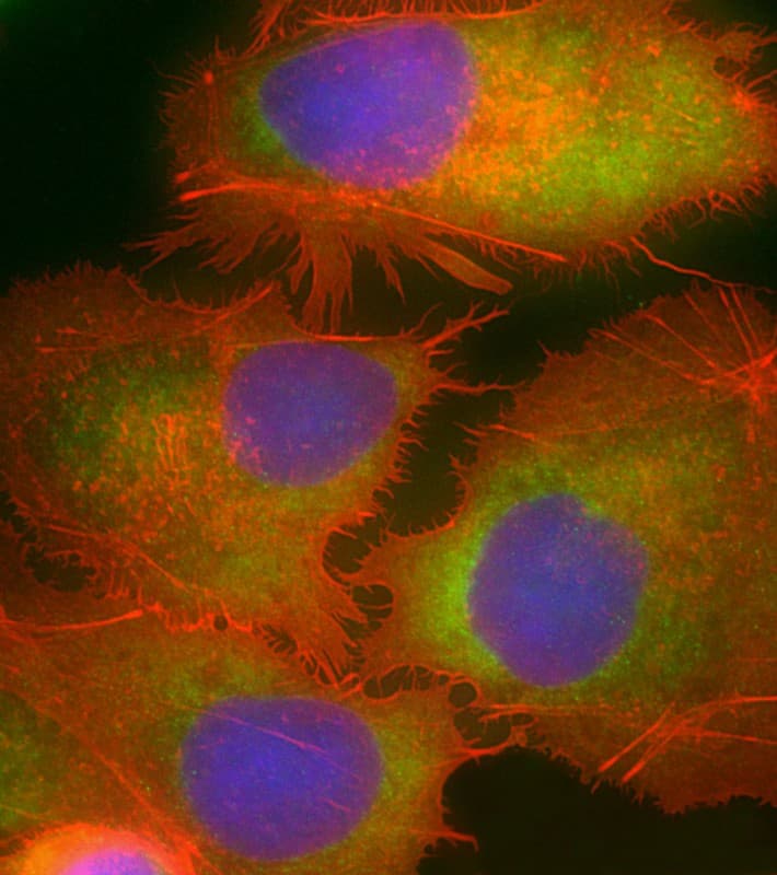 MKS1 Antibody (N-Terminus)