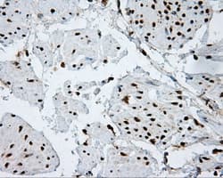 Monoclonal Mouse anti-Human ACLY / ATP Citrate Lyase Antibody (clone 3G8, Carrier-free, IHC, IF, WB)