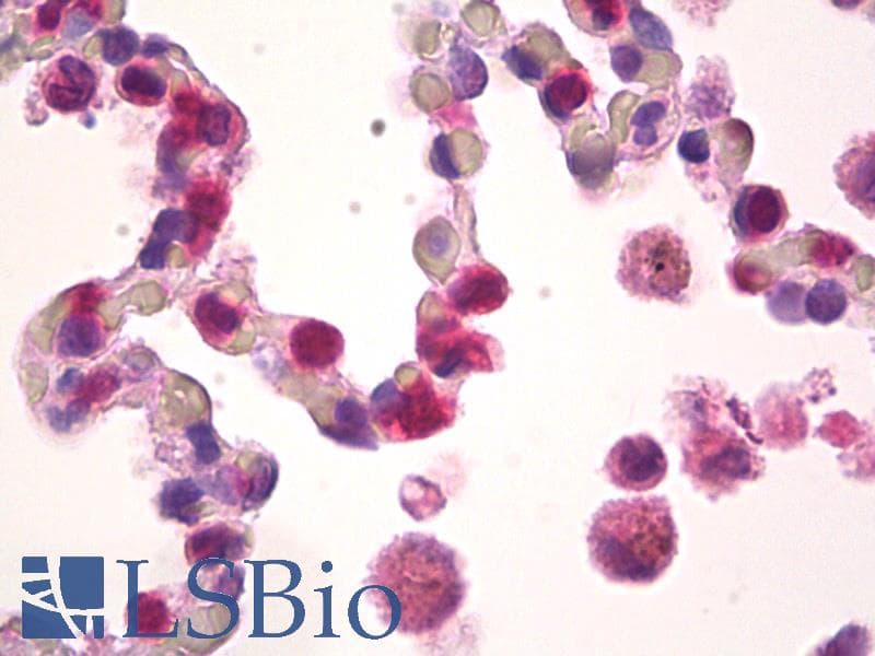 IHC-plus™ CLCF1 Antibody