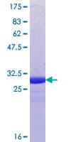 Human CSMD3 Protein (Recombinant GST, N-terminus)