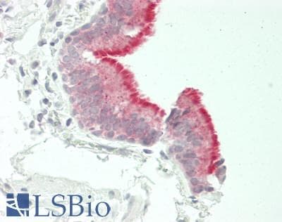 IHC-plus™ DSG4 / Desmoglein 4 Antibody (Internal)