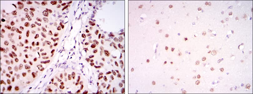 Monoclonal Mouse anti-Human PSIP1 / LEDGF Antibody (clone 6E4, IHC, IF, WB)