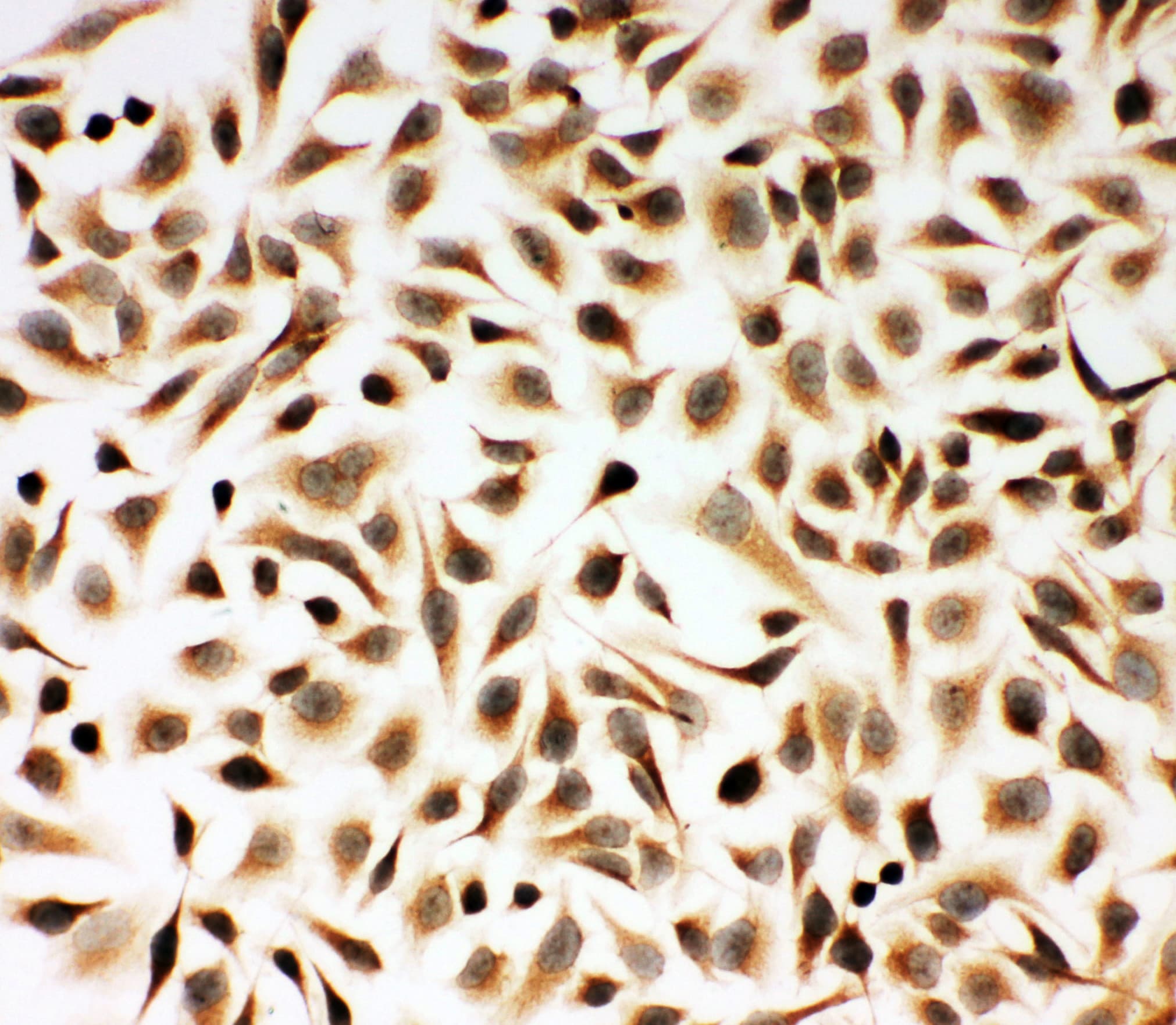 SMAD2 Antibody (aa94-112)