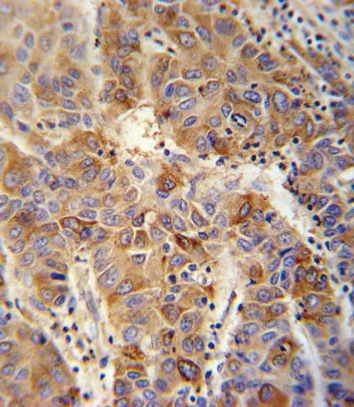 Polyclonal Rabbit anti-Human VAMP4 / VAMP-4 Antibody (aa16-45, IHC, WB)