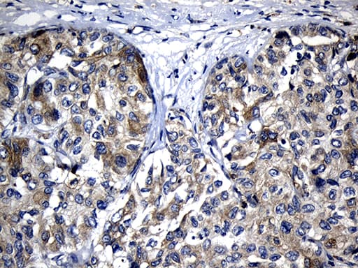 SLC9A1BP / CHP Antibody (clone OTI4B9)