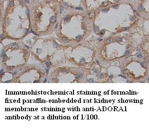 ADORA1 / Adenosine A1 Receptor Antibody (Internal)