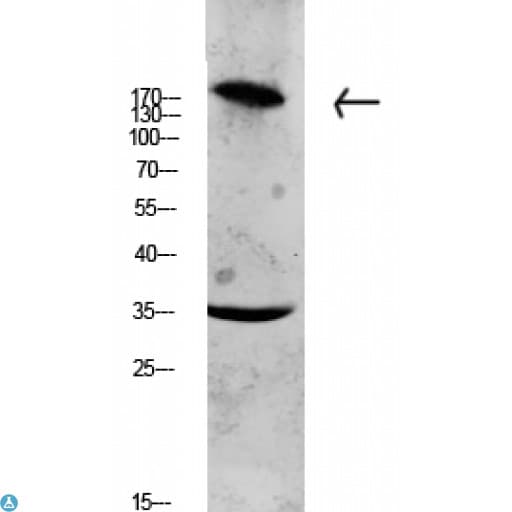 Polyclonal Rabbit anti-Human COL11A1 / Collagen XI Alpha 1 Antibody (WB)