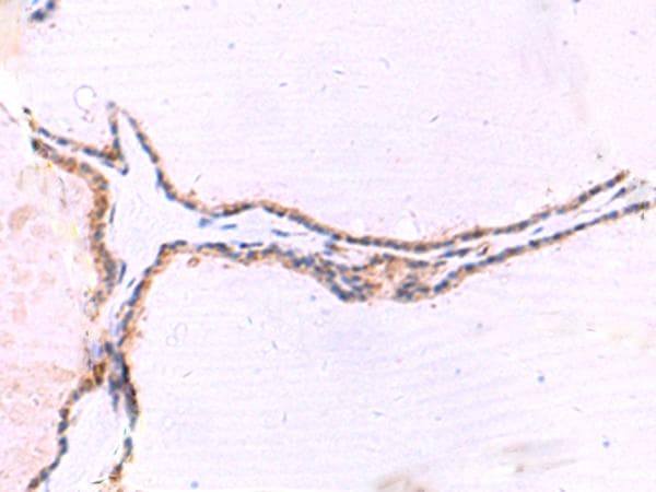IRGC1 / CINEMA Antibody