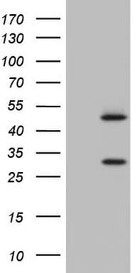 NR1I3 / CAR Antibody (aa1-236, clone OTI9E4)