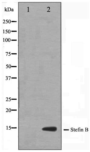 CSTB / Cystatin B / Stefin B Antibody