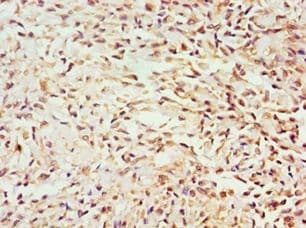 Polyclonal Rabbit anti-Human GEM / KIR Antibody (aa1-150, IHC)