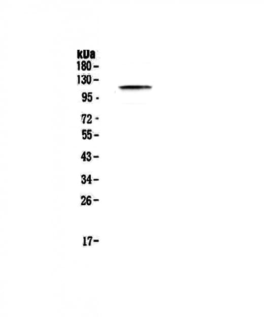 Polyclonal Rabbit anti-Human PMS2 Antibody (WB)