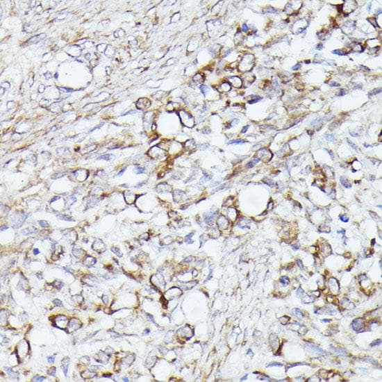 Polyclonal Rabbit anti-Human ACAT2 Antibody (IHC, IF)