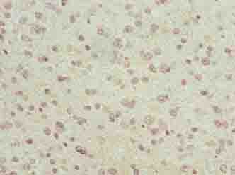 Polyclonal Rabbit anti-Human LRRC4C Antibody (IHC)