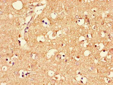 MLC1 / MLC Antibody