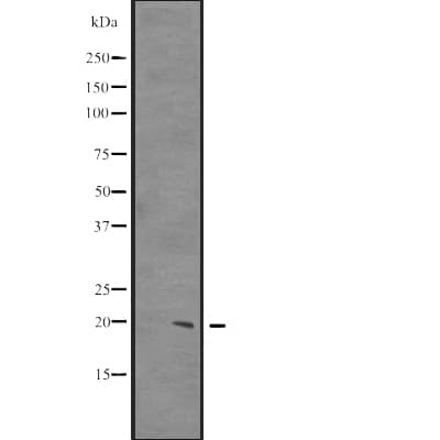 CIRP / CIRBP Antibody