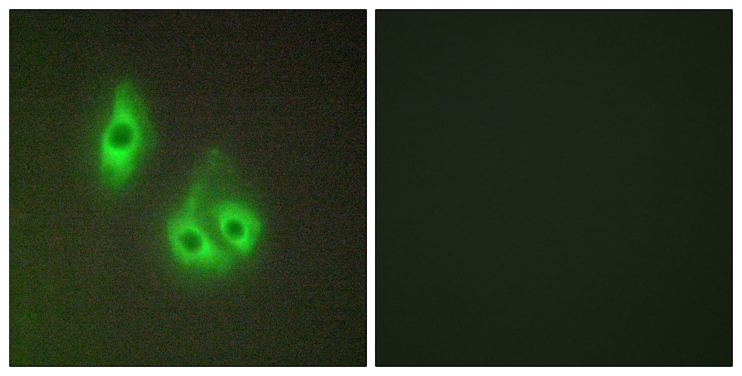 LAMA3 / Laminin Alpha 3 Antibody (aa2571-2620)