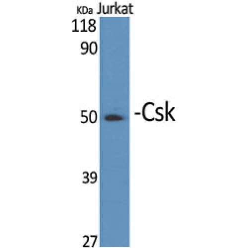 Polyclonal Rabbit anti-Human c-Src Kinase / CSK Antibody (300-380 aa, IHC, WB)