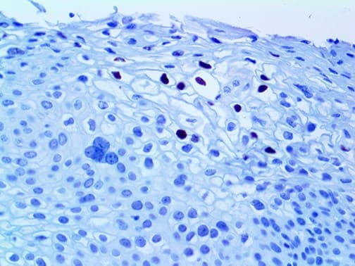 HPV16 L1 Antibody (clone CAMVIR-1)