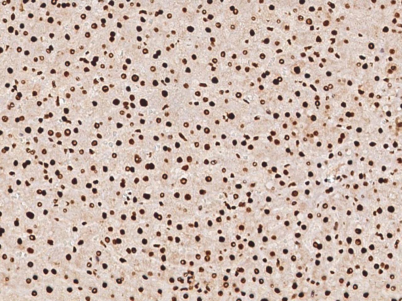Polyclonal Rabbit anti-Human DCPS Antibody (IHC, IF)