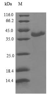 Human CALML3 Protein (Recombinant GST, N-terminus)