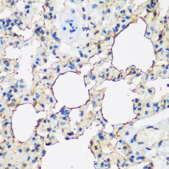 ALOX15 / 15-Lipoxygenase Antibody